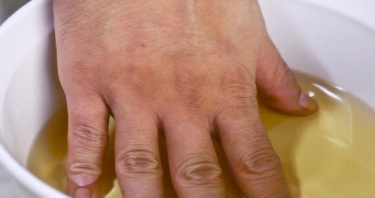 Il rimedio perfetto per i reumatismi: allevia i dolori alle articolazioni di braccia, gambe e collo!